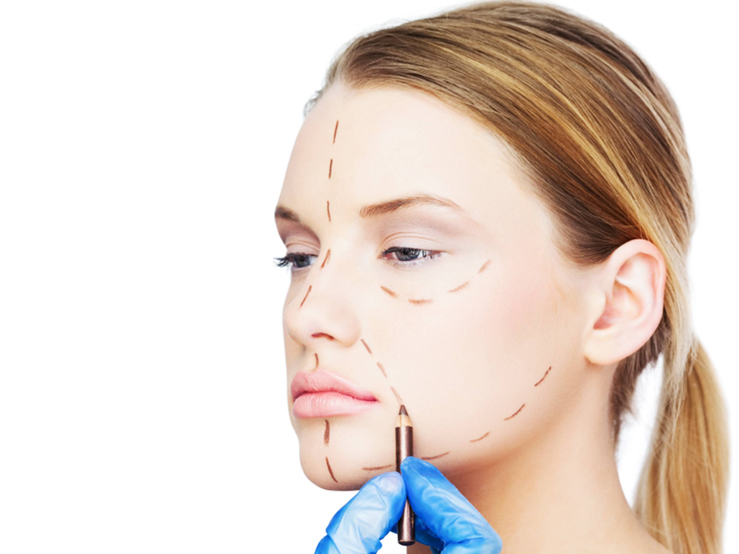 Lifiting facial: conheça os principais tipos do procedimento
