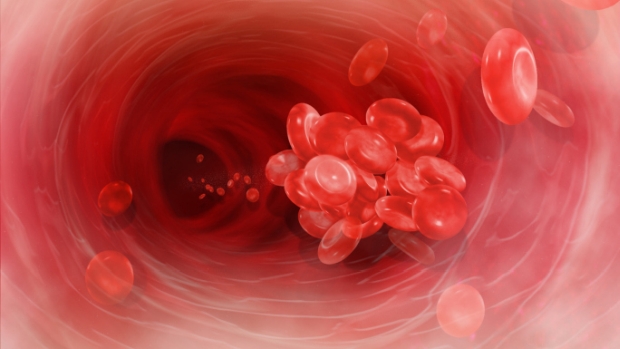 Parceria implementa inovação para tratar anemia pré-cirúrgica no SUS