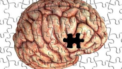 Alzheimer: entenda os estágios da doença que afeta ex-presidente FHC