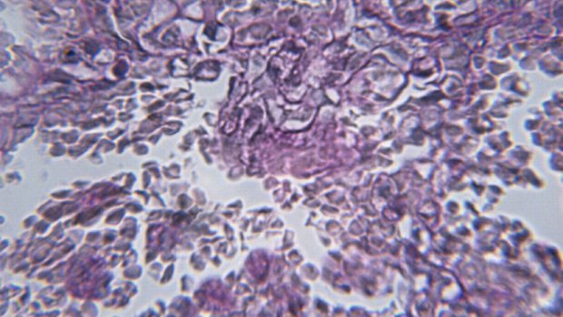 Autoteste em domicílio é alternativa para o diagnóstico sigiloso de ISTs