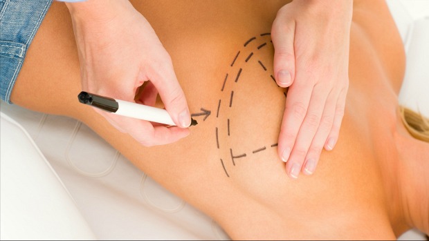 Como se recuperar bem de uma cirurgia plástica?