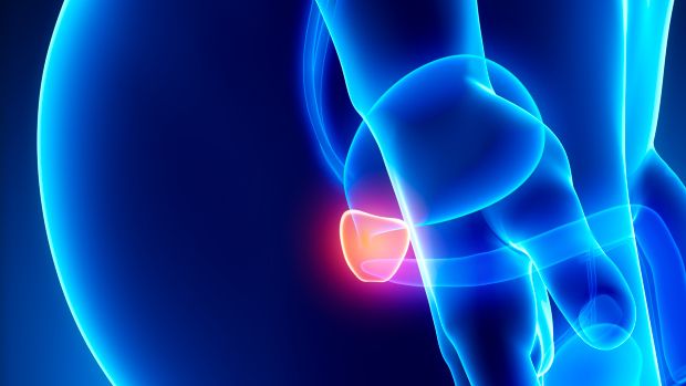 Câncer de próstata: o tempo é (e não é) o senhor da razão