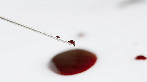 Só uma picada: exame para Alzheimer mais perto da realidade no Brasil