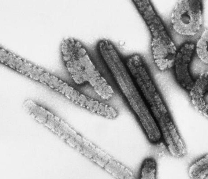 Etiópia registra primeiro surto de doença ‘prima’ do Ebola