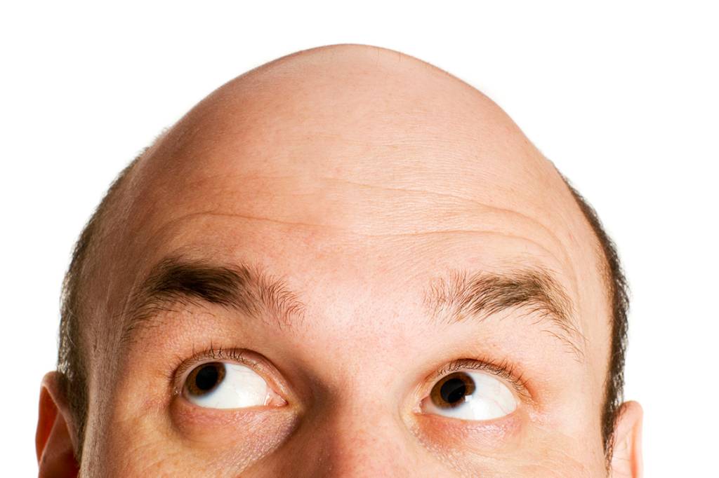 O que a calvície tem a ver com a Covid-19?