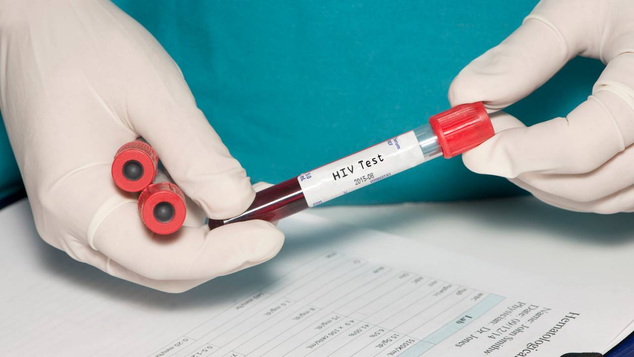 Teste de HIV