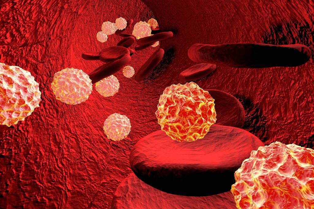 Homem tem a pior ‘supergonorreia’ no mundo e preocupa médicos