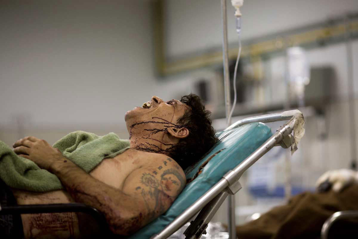 EXPRESSÃO DA DOR - O grito de Alexandre, torturado e atropelado: ataque com nível de brutalidade espantoso até para padrões cariocas