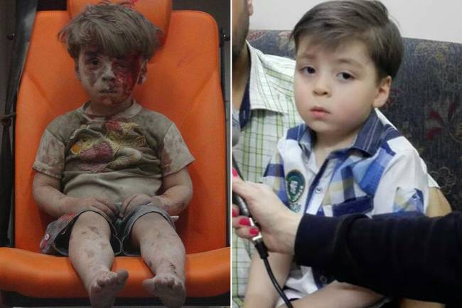 Omran Daqneesh