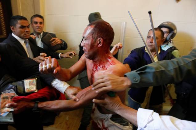 Homem coberto de sangue tenta deixar a Assembleia Nacional da Venezuela, após um grupo de apoiadores do governo de Nicolas Maduro invadiram a sede do Legislativo, controlada pela oposição, em protesto durante uma sessão parlamentar - 05/07/2017 Homem coberto de sangue tenta deixar a Assembleia Nacional da Venezuela, após um grupo de apoiadores do governo de Nicolas Maduro invadiram a sede do Legislativo, controlada pela oposição, em protesto durante uma sessão parlamentar - 05/07/2017