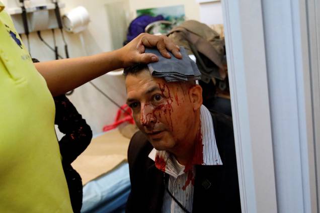 Homem coberto de sangue tenta deixar a Assembleia Nacional da Venezuela, após um grupo de apoiadores do governo de Nicolas Maduro invadiram a sede do Legislativo, controlada pela oposição, em protesto durante uma sessão parlamentar - 05/07/2017 Homem coberto de sangue tenta deixar a Assembleia Nacional da Venezuela, após um grupo de apoiadores do governo de Nicolas Maduro invadiram a sede do Legislativo, controlada pela oposição, em protesto durante uma sessão parlamentar - 05/07/2017