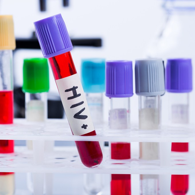 HIV: Após Trump congelar recursos, OMS e entidades expressam preocupação com possível ameaça global