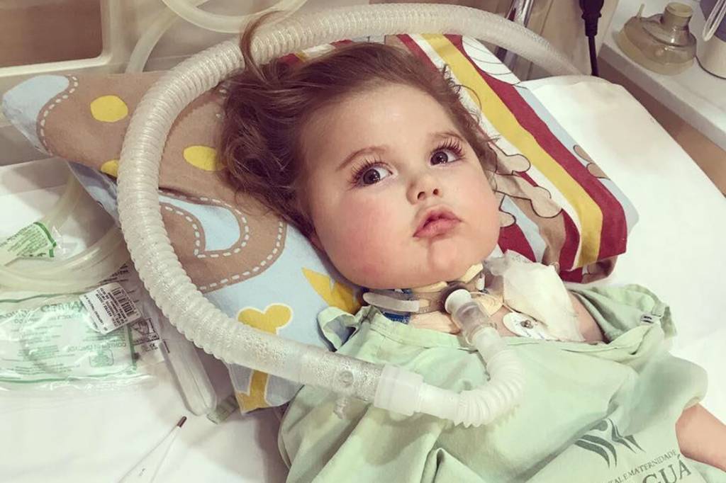 O beb&ecirc; Jonatas, no primeiro dia de tratamento com medicamento importado dos EUA
