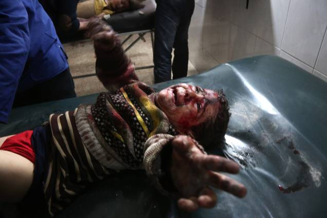 Criança síria ferida em bombardeios atribuídos às forças do governo chora enquanto recebe tratamento em um hospital na cidade rebelde de Hamouria, na região sitiada de Ghouta Oriental, nos arredores da capital, Damasco - 19/02/2018 Criança síria ferida em bombardeios atribuídos às forças do governo chora enquanto recebe tratamento em um hospital na cidade rebelde de Hamouria, na região sitiada de Ghouta Oriental, nos arredores da capital, Damasco - 19/02/2018