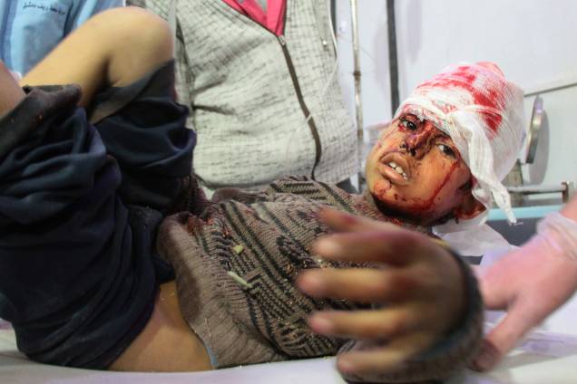 Menino ferido recebe tratamento em um hospital em Douma após ataques aéreos do governo na aldeia síria de Mesraba, na região sitiada de Ghouta Oriental, nos arredores da capital Damasco - 19/02/2018 Menino ferido recebe tratamento em um hospital em Douma após ataques aéreos do governo na aldeia síria de Mesraba, na região sitiada de Ghouta Oriental, nos arredores da capital Damasco - 19/02/2018