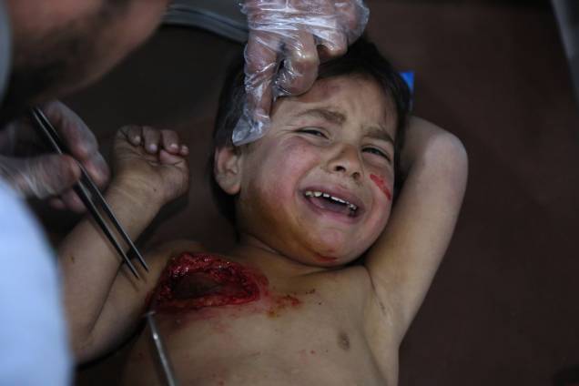 O pequeno Mohammed chora enquanto recebe tratamento em um hospital em Kafr Batna depois de ter sido ferido com sua mãe nos ataques aéreos das forças do governo na cidade de Jisreen, na região sitiada de Ghouta Oriental - 20/02/2018 O pequeno Mohammed chora enquanto recebe tratamento em um hospital em Kafr Batna depois de ter sido ferido com sua mãe nos ataques aéreos das forças do governo na cidade de Jisreen, na região sitiada de Ghouta Oriental - 20/02/2018