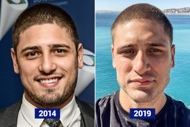 DANIEL ROCHA, 28 ANOS - Casado com uma dermatologista, o ator causou comoção recentemente ao mostrar seu novo visual: boca preenchida e, acima de tudo, maxilares e queixo mais protuberantes. O efeito deixa o rosto mais forte e masculino — virou o grande pedido de homens em clínicas de estética. Resultado: bastante perceptível DANIEL ROCHA, 28 ANOS - Casado com uma dermatologista, o ator causou comoção recentemente ao mostrar seu novo visual: boca preenchida e, acima de tudo, maxilares e queixo mais protuberantes. O efeito deixa o rosto mais forte e masculino — virou o grande pedido de homens em clínicas de estética. Resultado: bastante perceptível
