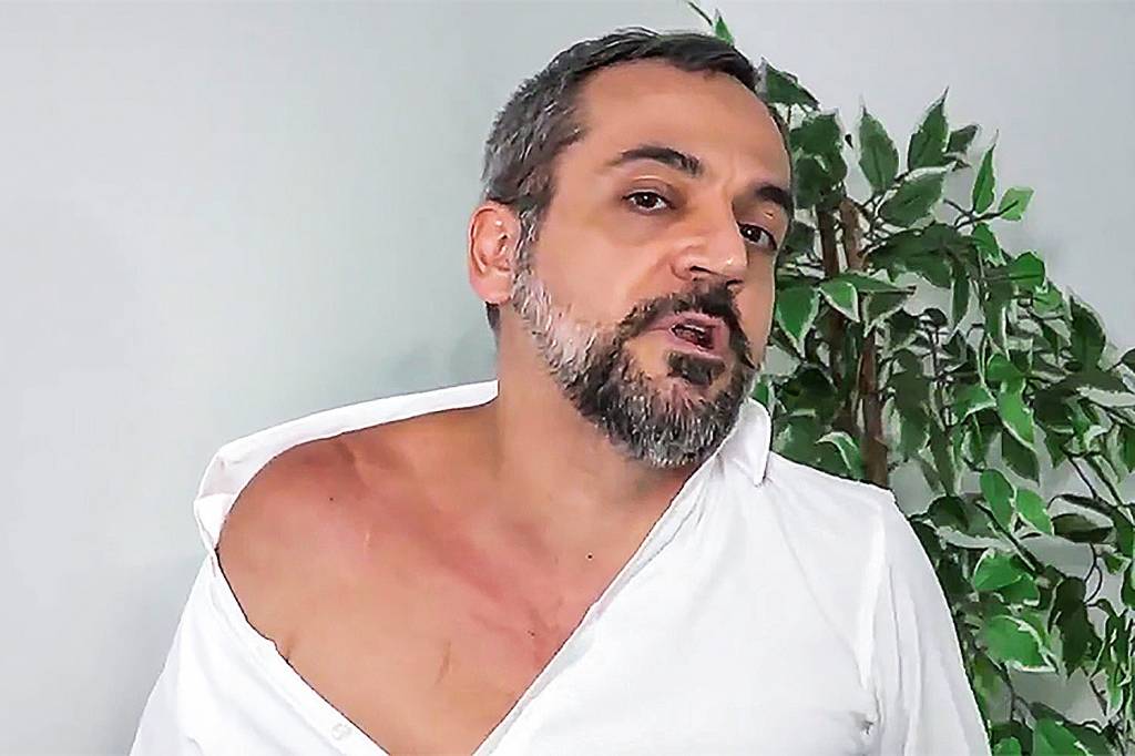 ABRAHAM-WEINTRAUB-CICATRIZ-2019-5438.jpg ABRAHAM-WEINTRAUB-CICATRIZ-2019-5438.jpg