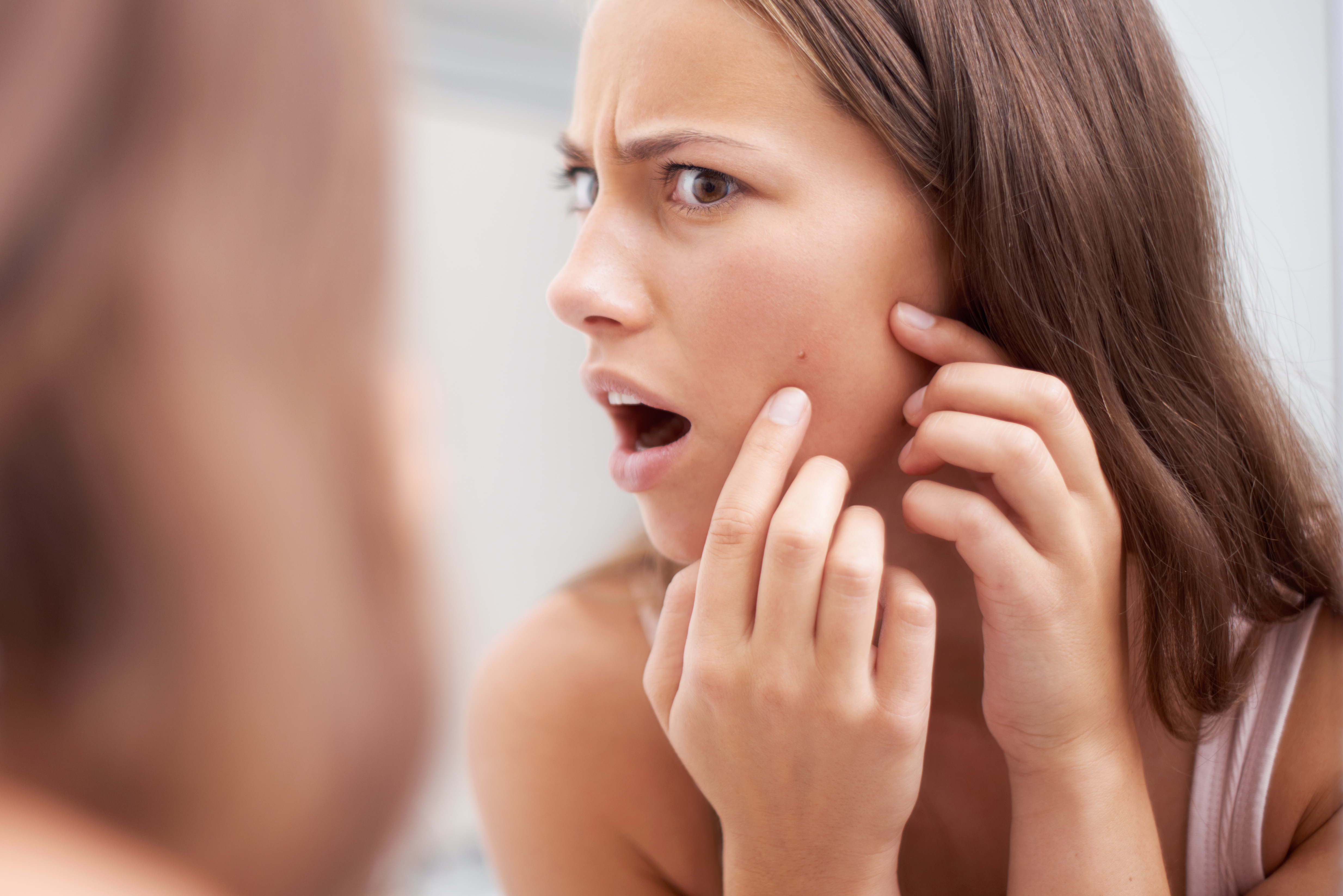 Acne: por que a doença está crescendo entre as mulheres adultas
