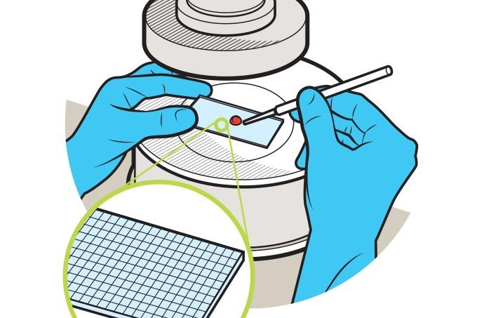 Tendências da medicina para 2025: o que vai mudar nos exames