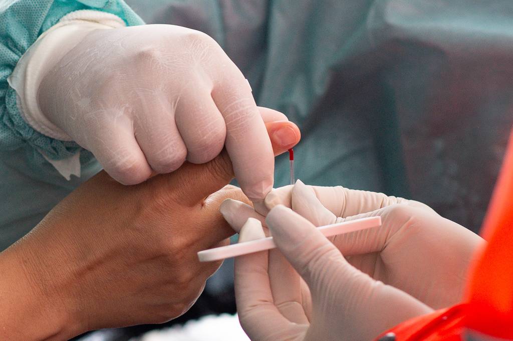 Partículas mortas de coronavírus podem alterar resultado de testes