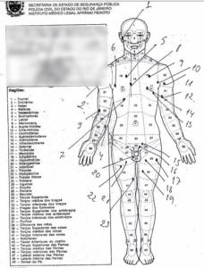 Laudo mostra que seis das 30 perfurações no corpo de Anderson do Carmo foram na região da genitália