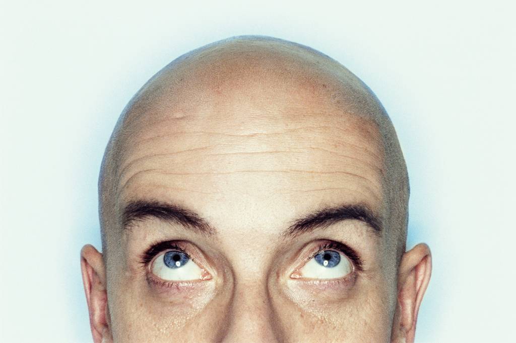 A procura pelos tratamentos contra a calvície cresceu na quarentena