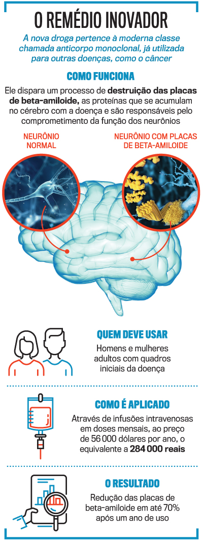 arte alzheimer