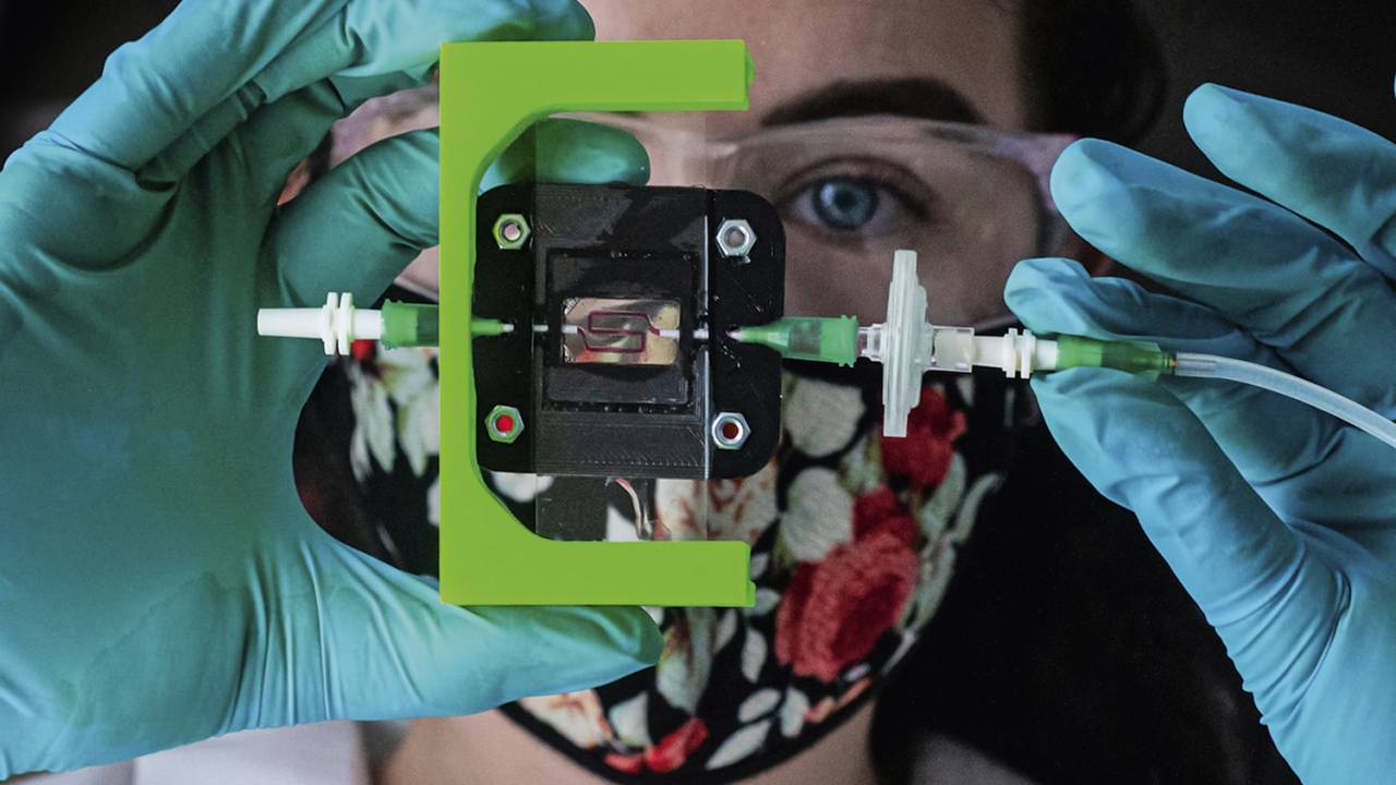 PRECISÃO - Implante inteligente criado nos EUA: mede o açúcar no sangue e libera insulina só quando realmente necessário -