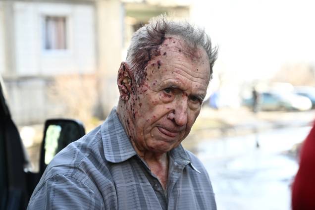 Homem ferido recebendo assistência médica após bombardeios na cidade de Chuguiv, no leste da Ucrânia - Homem ferido recebendo assistência médica após bombardeios na cidade de Chuguiv, no leste da Ucrânia -