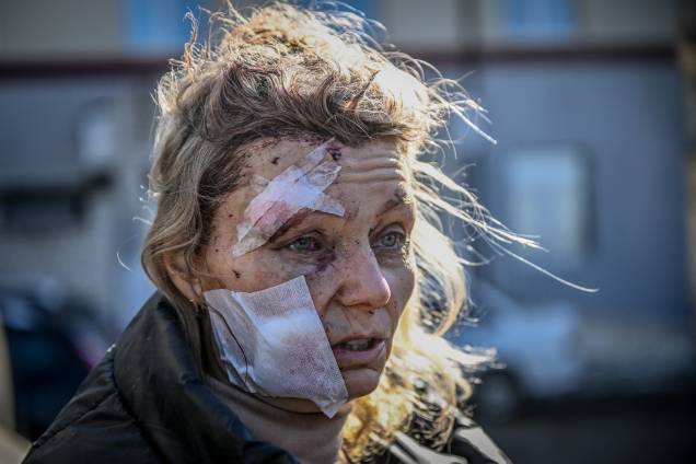 Mulher ferida após um bombardeio da cidade de Chuguiv, no leste da Ucrânia - Mulher ferida após um bombardeio da cidade de Chuguiv, no leste da Ucrânia -
