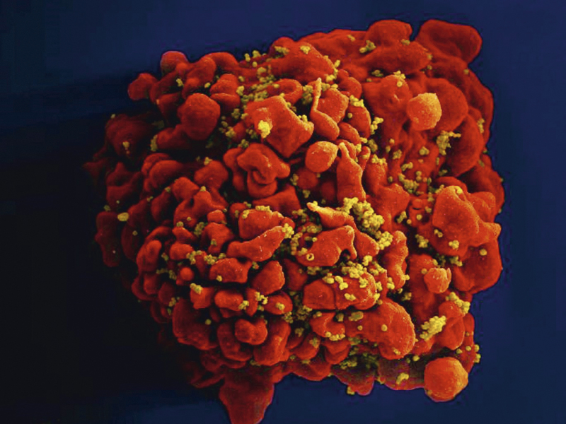 ATAQUE - Célula infectada por HIV: danos ao material genético -