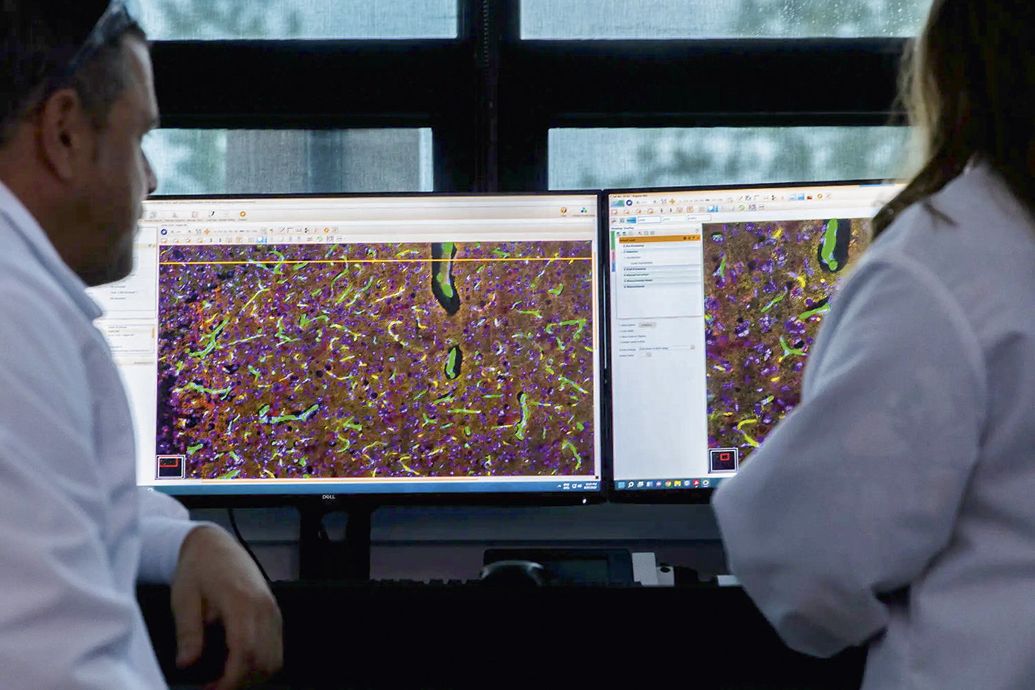PROMESSA -&ensp;Pesquisa da Elevian: estudo para saber a real efic&aacute;cia de prote&iacute;na -