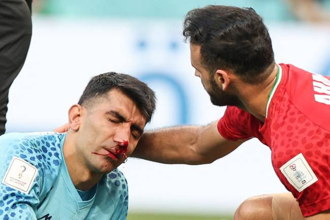 Alireza Beiranvand Irã Alireza Beiranvand recebe atendimento após choque com companheiro -