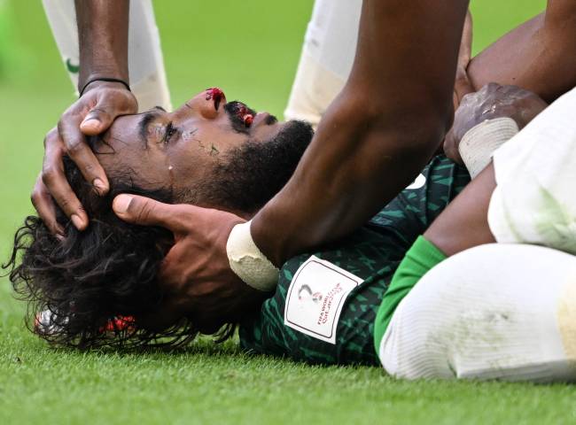 FBL-WC-2022-MATCH08-ARG-KSA Al-Shahrani ficou desacordado em campo -