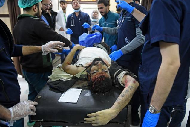 Um homem ferido em um hospital após um terremoto mortal que abalou a Síria na madrugada - Um homem ferido em um hospital após um terremoto mortal que abalou a Síria na madrugada -