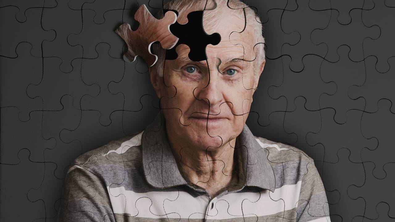 QUEBRA-CABEÇA: Danos no cérebro: o desafio dos pesquisadores é conter a progressiva e irreversível perda cognitiva