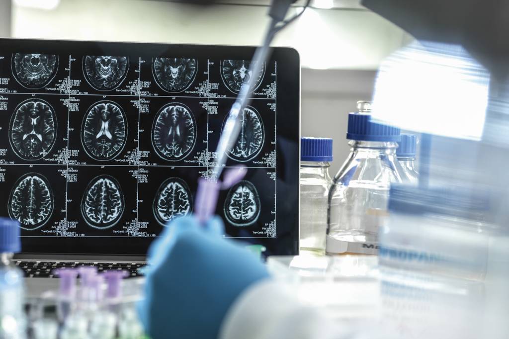 GettyImages-1339206982.jpg NO LABORATÓRIO - Alto custo: EUA investem milhões de dólares para financiar estudos