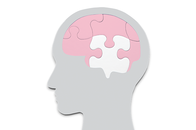 Alzheimer: mais um medicamento que retarda doença é aprovado pela Anvisa