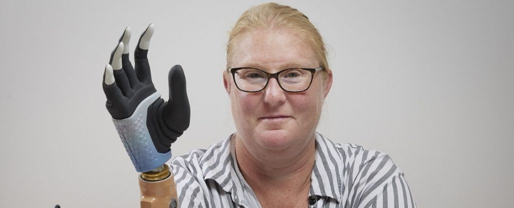 Após um acidente agrícola, Karin (cujo sobrenome não foi divulgado) passou 20 anos sem uma das mãos, vivendo com dores fantasmas excruciantes. O implante foi feito há três anos e buscou pela perfeita integração entre biologia e robótica -
