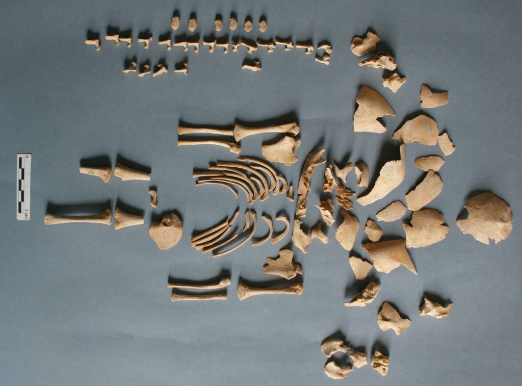 Pesquisadores identificam Síndrome de Down em fósseis pré-históricos