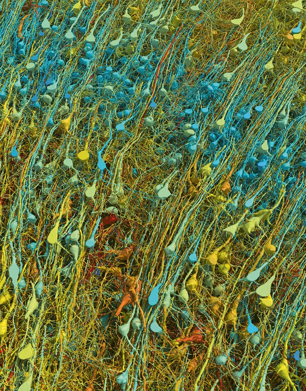 2—Close-up-view-of-excitatory-neur.width-1000.format-webp-copy.jpg CLOUSE-UP - Neurônios em ação: imagem captada pelos cientistas do Google