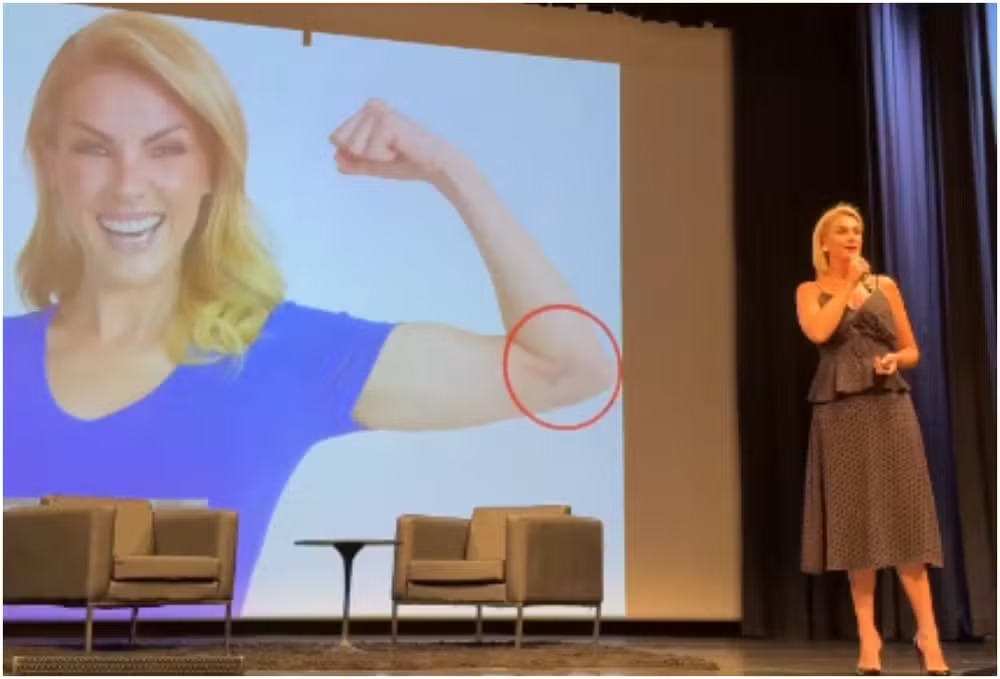 Ana Hickmann se emociona ao mostrar seus hematomas de violência doméstica