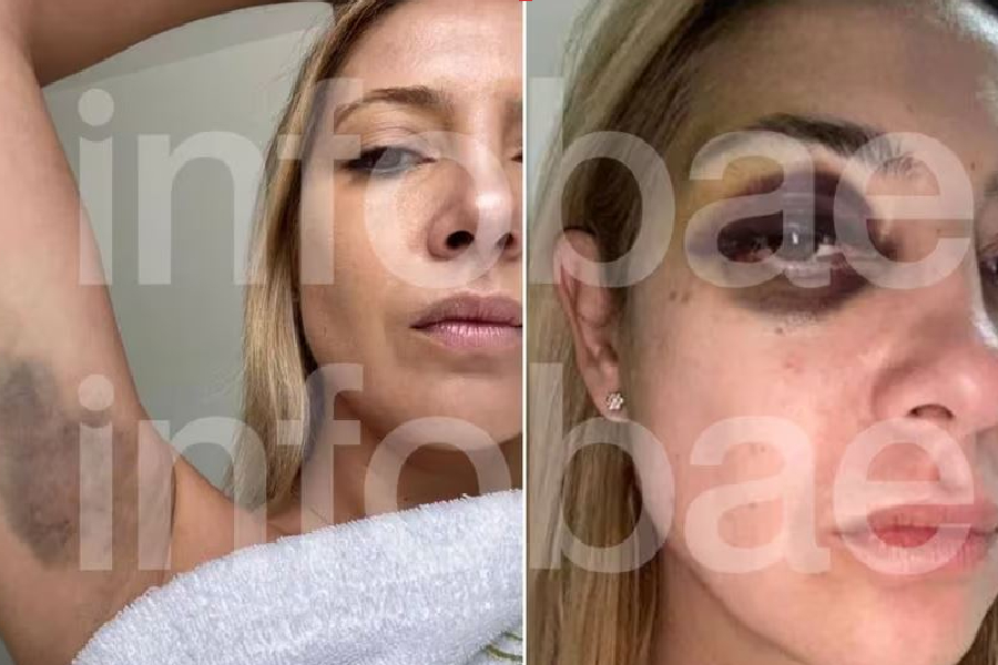 ‘Dê um tiro na cabeça’, diz aliado do ex-presidente argentino espancador