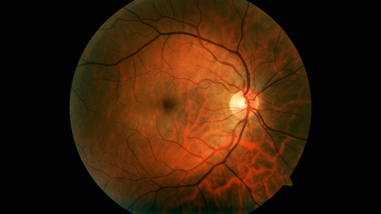 ESTRUTURA PRECIOSA - A retina, no fundo do olho: tecido é fundamental para a captação e a leitura das imagens