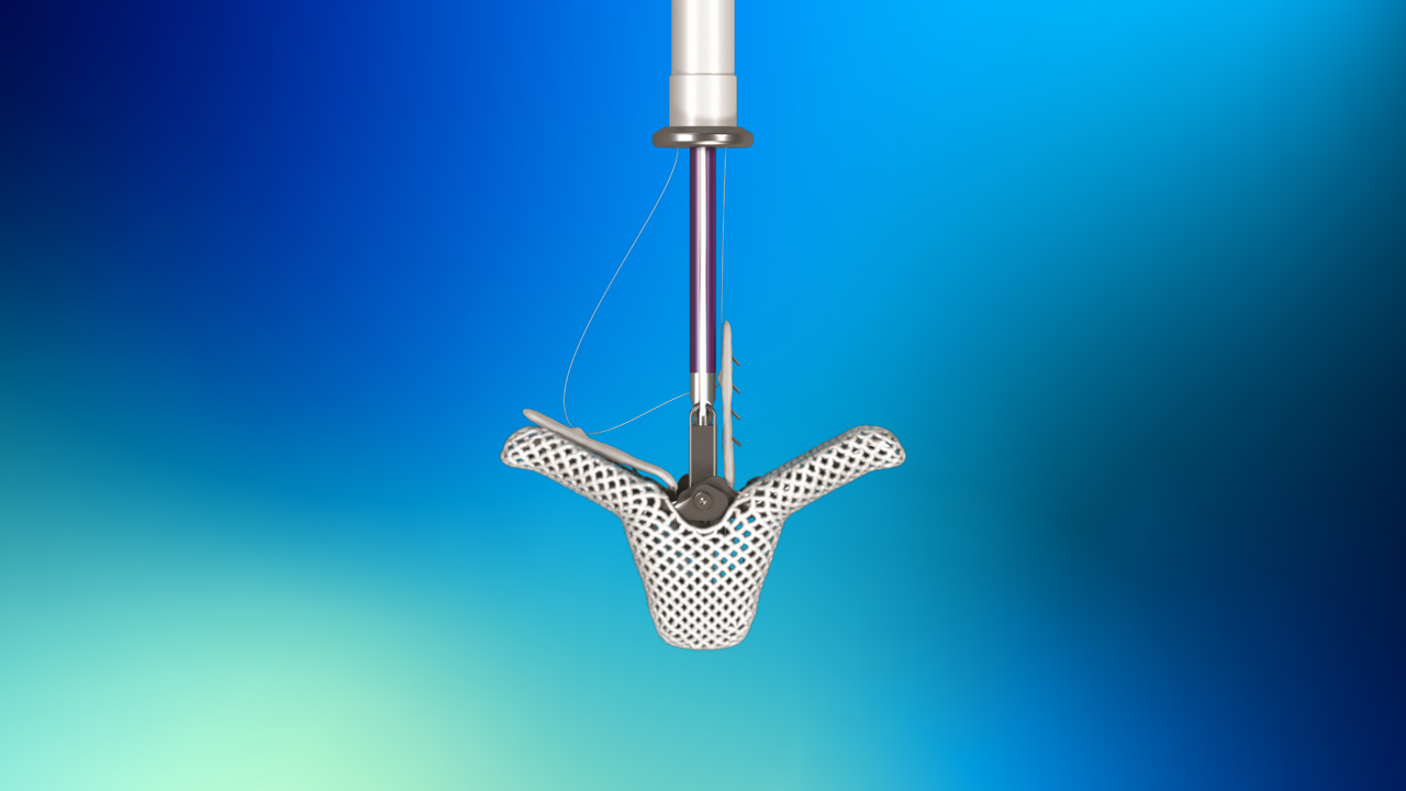 TriClip™ G4: o dispositivo é inserido através de uma incisão na perna e, guiado por imagens ao vivo, ele se posiciona nas folhetas da válvula tricúspide para melhorar o fluxo sanguíneo e reduzir o refluxo