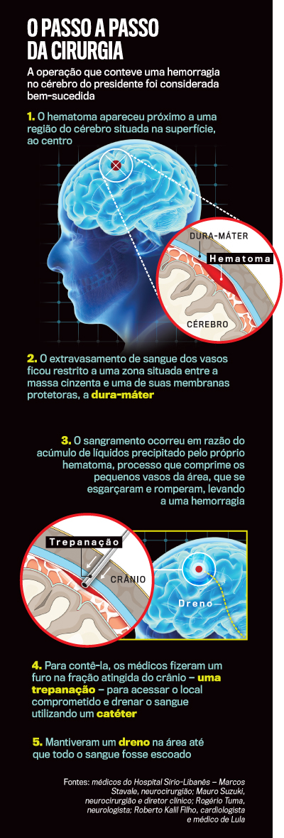 arte-cirurgia-Lula-digital-2923 arte cirurgia Lula