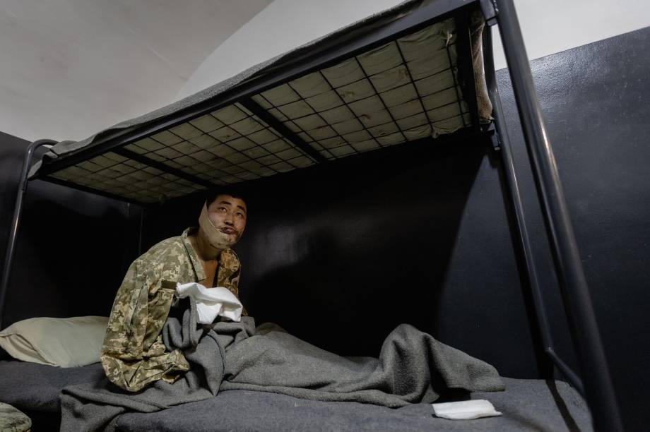FERIDO NOS BRAÇOS - Soldado Norte-Coreano: capturado na Rússia