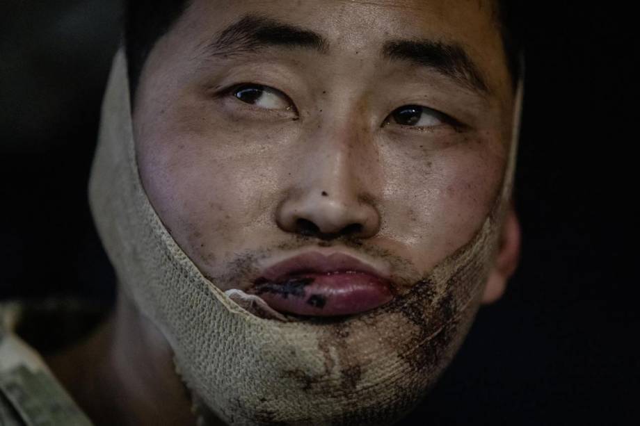 FERIDO NA MANDÍBULA - Soldado Norte-Coreano: capturado na Rússia