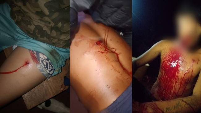 indigenas parana Uma criança e um jovem estão entre indígenas baleados em ataque da noite de 3 de janeiro de 2025 à comunidade Avá-Guarani, no Paraná